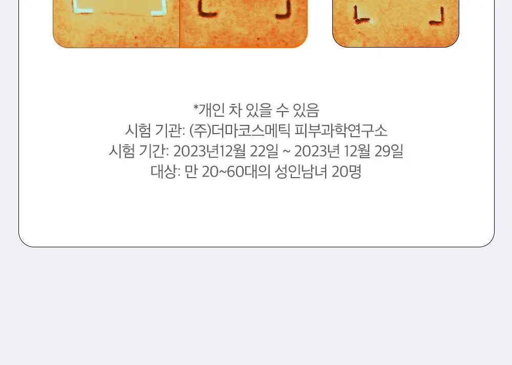 [블랙헤드 지우개] 파파레서피 블레미쉬 클렌징 오일 300ml 상세페이지 24